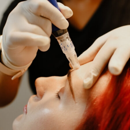 skin-pen-microneedling (3)-at-natural-body-spa-med-spa-atlanta-276x276