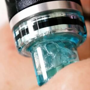 Hydrafacial wand close up showing method of action