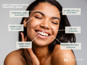 Diagram of Dysport Treatment Areas at Natural Body Spa + Med Spa in Atlanta, 1000x750