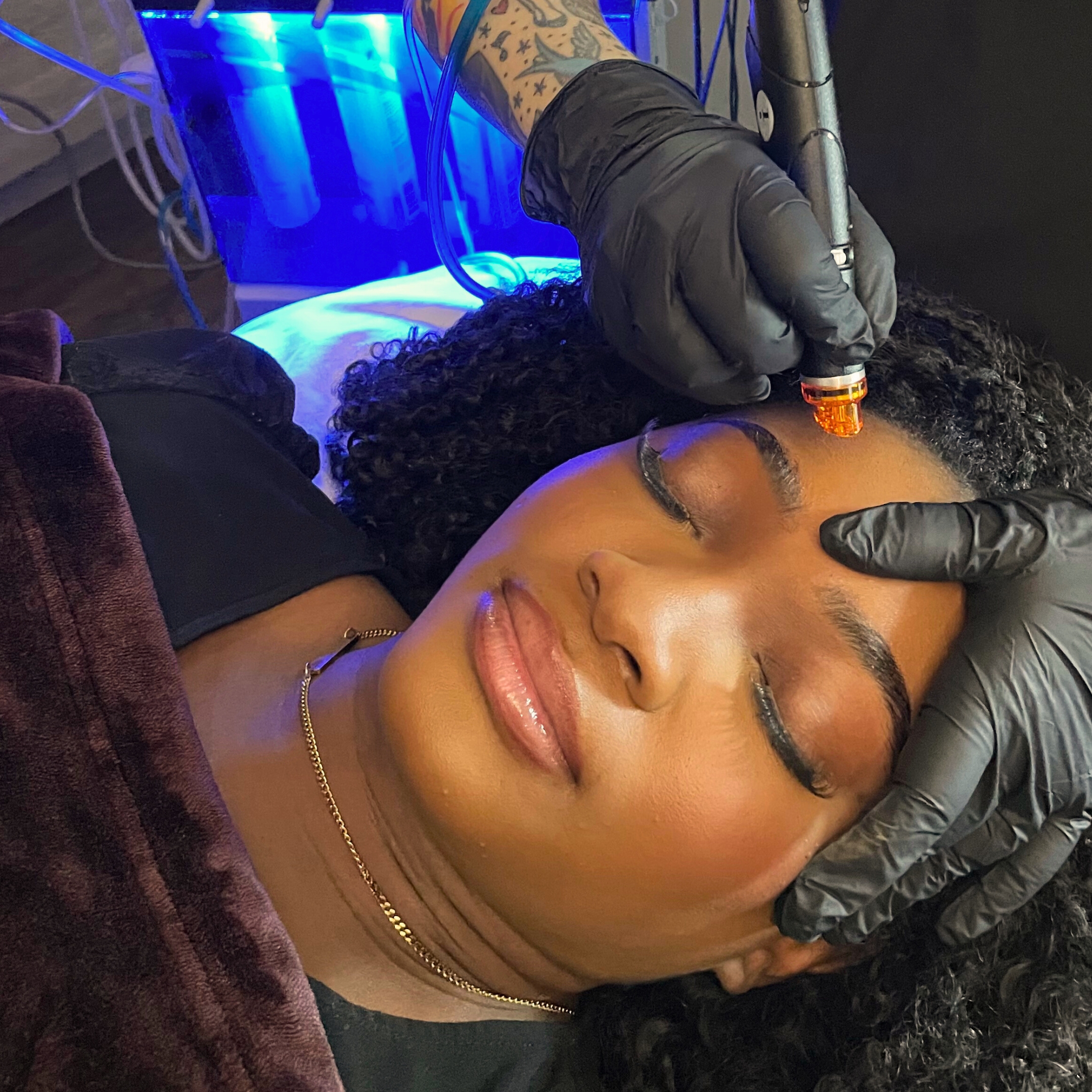 Woman enjoying a Hydrafacial treatment clearing up congestion and clogged pores on forehead